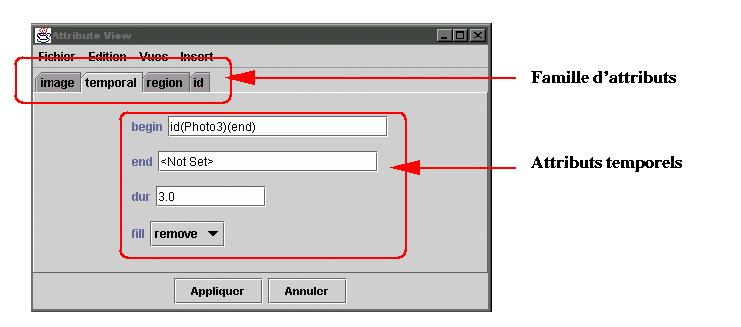 Vue attributs